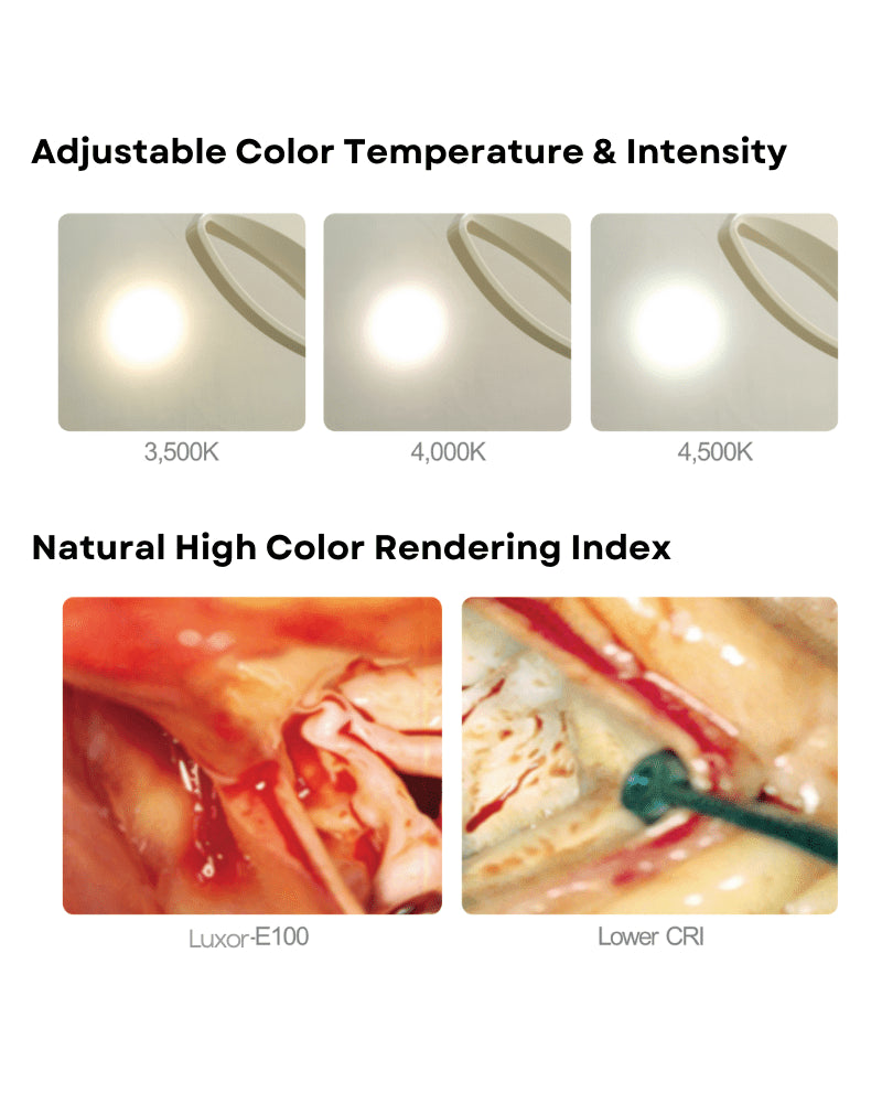Luxor 100 Series Procedure & Exam Lights